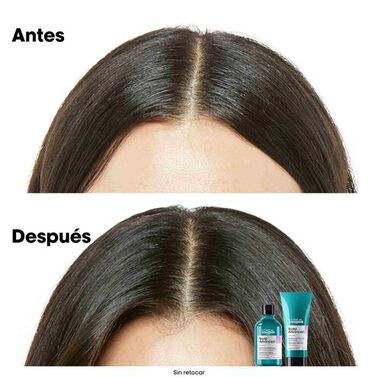 Shampoo Dermo-regulador Anti-irritación - L'Oréal Professionnel | L'Oréal Partner Shop